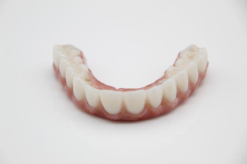 Front angle of an all-on-4 denture in Mexico.